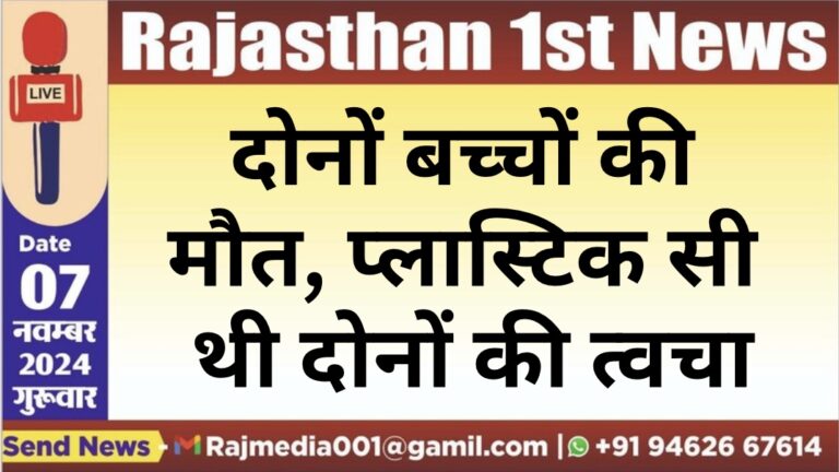 Read more about the article दोनों बच्चों की मौत, प्लास्टिक सी थी दोनों की त्वचा